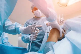 Arthroscopy